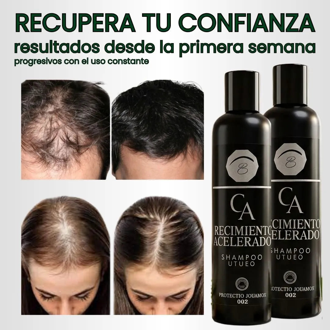 ✨ DETÉN LA CAÍDA Y RECUPERA TU MELENA✨