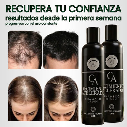 ✨ DETÉN LA CAÍDA Y RECUPERA TU MELENA✨