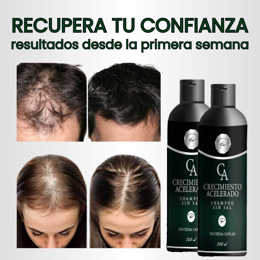 ✨ Shampoo Crecimiento Acelerado✨